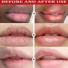 Fast Remove Dark Lip Balm Serum Lighten Melanin Lip Mask Exfoliating Fade Lip Lines Dead Skin Nourishing Repair Lip Care Makeup