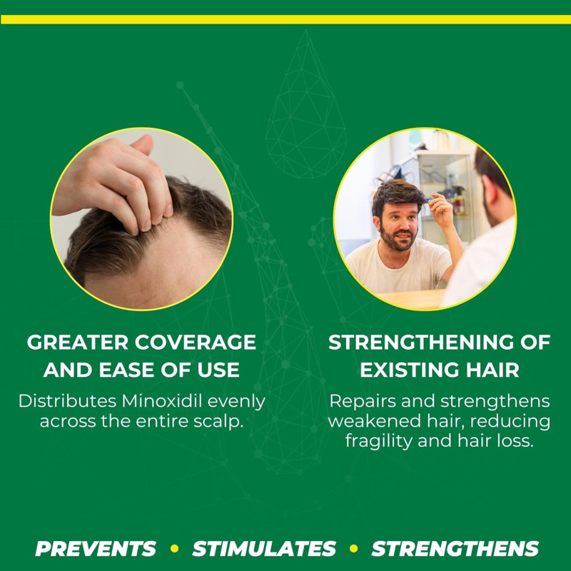 Crece Pelo Hair Regrowth Super Kit Plus – 4-Piece Set with Minoxidil 2% & 5% – Anti Hair Loss Treatment 